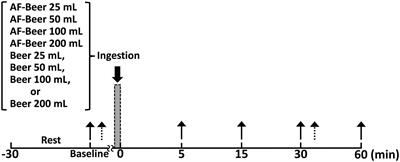 Dose of Alcohol From Beer Required for Acute Reduction in Arterial Stiffness